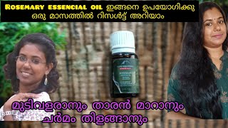 How to use rosemary essencial oil for fast hair growth alps goodness rosemary oil review malayalam [upl. by Prunella595]