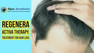 Regenera Activa Therapy in Hyderabad for hair loss by Ojas Aesthetic [upl. by Sivat]