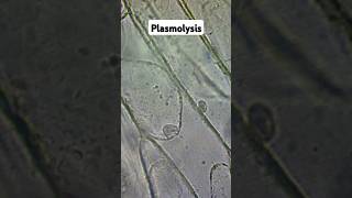 Plasmolysis and Osmosis biology gcse [upl. by Annanhoj463]