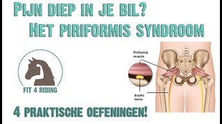 Fit4Riding  Piriformis syndroom [upl. by Oirram]