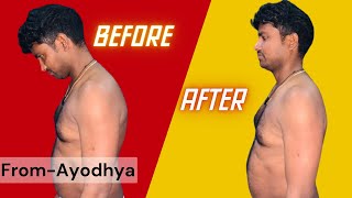 Ankylosing Spondylitis Treatment chiropractormoradabad chiropractorindia ankylosingspondylitis [upl. by Aicilav]