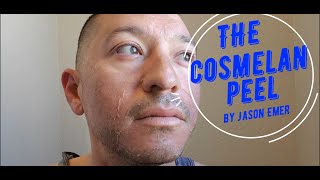 Cosmelan Day 3  Nighttime Routine [upl. by Pape]