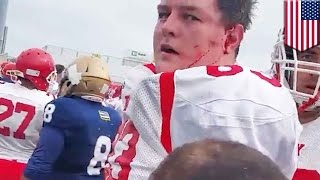 NYPD vs FDNY Cops fight firefighters when annual football charity match turns violent  TomoNews [upl. by Eseenaj]