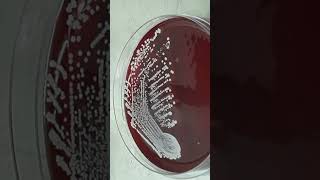 Growth Character of Staphylococcus hominis on Blood Agar Colony Morphology and Diagnostic Insights [upl. by Westberg413]