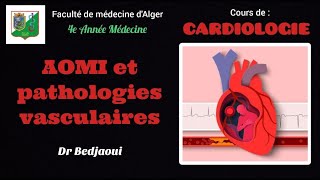 15 AOMI et Pathologies Vasculaires  Dr Bedjaoui [upl. by Harilda]