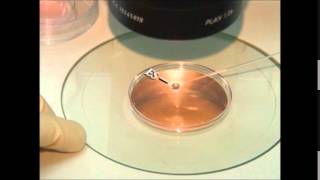 vitrification of embryos and oocytes [upl. by Assiled]