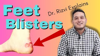 Feet Blisters Causes and Treatment  Dr Rizvi Explains [upl. by Marentic]