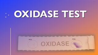 Oxidase Test [upl. by Romano]