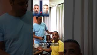 Mryılmaz achieved amazing hair transplant results after 5 months hairtransplantresults [upl. by Airpac485]