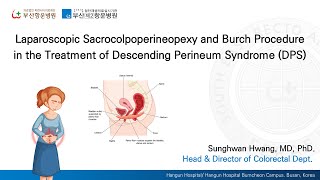 Laparoscopic SacrocolpoperineopexyampBurch Procedure in the Treatment of Descending Perineum Syndrome [upl. by Weber937]