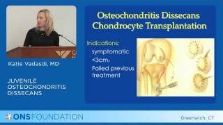 Juvenile Osteochondritis Dissecans Injuries of the Knee [upl. by Dolan600]