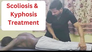 Sపార్శ్వగూని మరియు కైఫోసిస్ చికిత్సscoliosis amp Kyphosis treated by Indian chiropractor 7023645760 [upl. by Enitselec]