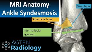 MRI Anatomy of Ankle Ligaments Syndesmosis [upl. by Aehtela]