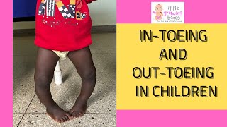 why childrens feet face funny directions [upl. by Reitman996]