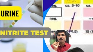 Urine Nitrite testTest for UTI [upl. by Anne-Corinne879]