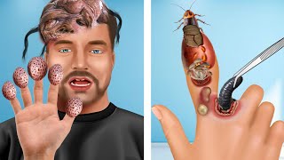 ASMR Animation Treatment Remove the cockroach between Elon Musk fingers [upl. by Ateerys]