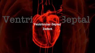 Normal Heart Sounds vs Ventricular Septal Defect Murmur [upl. by Yate713]