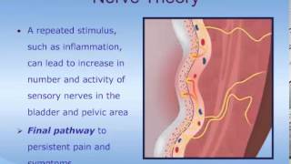 Understanding Interstitial Cystitis ICPainful Bladder Syndrome PBS [upl. by Rivard]