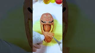 Potato has a Baby Need Emergency Surgery jidoodle fruitsurgery foodsurgery [upl. by Omor]