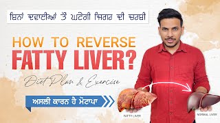 How Weight Loss Reverse Fatty Liver Symptoms Treatment I Diet amp Exercise I Dr Navdeep Singh [upl. by Ycal302]