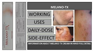 melano tx cream के फ़यादे हिंदी में  use of melanotx cream in hindi  melesma cream melano [upl. by Rosati]