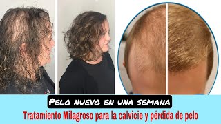 El Mejor ACEITE Natural para Hacer Crecer el Cabello [upl. by Zeni70]