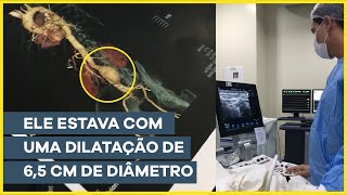 Aneurisma de aorta abdominal tratado com sucesso [upl. by Arraeit674]