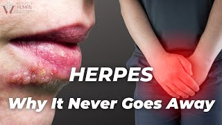 Why Herpes never goes away  The Institute of Human Anatomy [upl. by Eselahs]