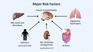 Hepatic Encephalopathy [upl. by Liek]