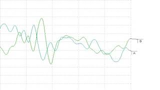 Cochlear Microphonic [upl. by Gerick287]