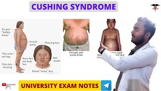 Cushing Syndrome  Endocrine Physiology [upl. by Egiap]