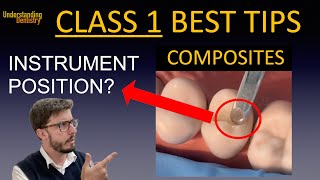 Class 1 Composite Restoration Lecture Occlusal restoration molars and premolars dental filling [upl. by Oyr]