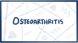 Osteoarthritis  causes symptoms diagnosis treatment amp pathology [upl. by Earas957]