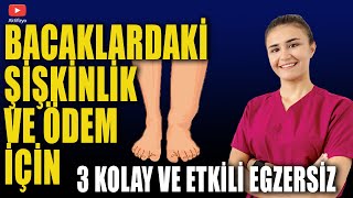 BACAKLARDAKÄ° Ã–DEM VE ÅžÄ°ÅžKÄ°NLÄ°K TEDAVÄ°SÄ° Ã‡ok Kolay ve Etkili Egzersizler [upl. by Dominus490]