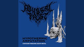 Hypothermic Amputation [upl. by Severin]