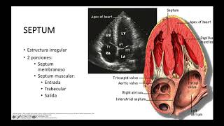 comunicación interventricular [upl. by Turro]