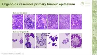 Investigating colorectal cancer using epithelial organoid cultures [upl. by Aicxela]