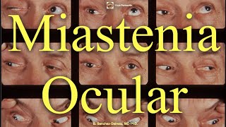 Miastenia Ocular [upl. by Rentsch]