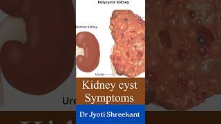 Kidney cyst symptoms shorts [upl. by Amabel750]