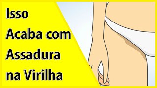 Como Tratar Assadura na Virilha em Casa [upl. by Akinna]