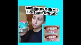 HOW TO WHITEN TEETH AT HOME IN 2 MINUTES  USING BICARBONATE OF SODA TO WHITEN TEETH [upl. by Dressel]