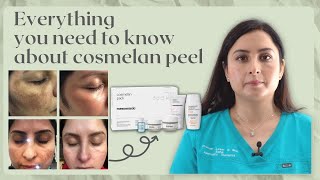 COSMELAN PEEL  SENIOR PRACTITIONERS GUIDE TO Hyperpigmentation treatment [upl. by Adaynek]