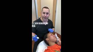 Acne Scar Treatment  RadioFrequency Skin Remodeling  Inmodes Fractora  Dr Jason Emer [upl. by Shulem]