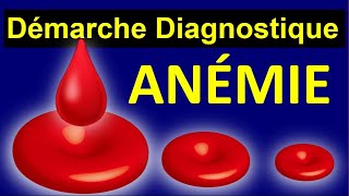 Diagnostique des Anémies Causes Megaloblastique par Carence Arégénérative Hémolytique Auto immune [upl. by Eikcim]