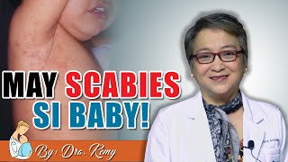 MAY SCABIES SI BABY GALIS ASO [upl. by Yma]