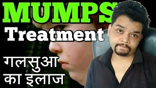 Mumps Treatment CausesSymptoms In Hindi [upl. by Joerg212]