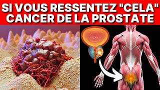 CANCER de la PROSTATE  Premiers SIGNES et SYMPTÔMES NE LIGNOREZ PAS [upl. by Jess814]