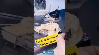 Zirconia crown vs Metal crown oralhealth dentist dentalclinic doctor viralvideo shirtscrown [upl. by Etoile]