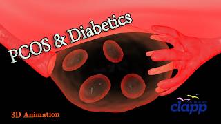 PCOS AND DIABETICS  3D Animation [upl. by Egon217]