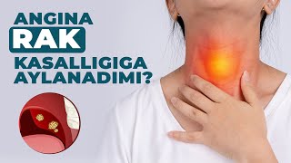 Angina Rak Kasalligiga Aylanadimi Videoni to’liq ko’ring [upl. by Uhp]